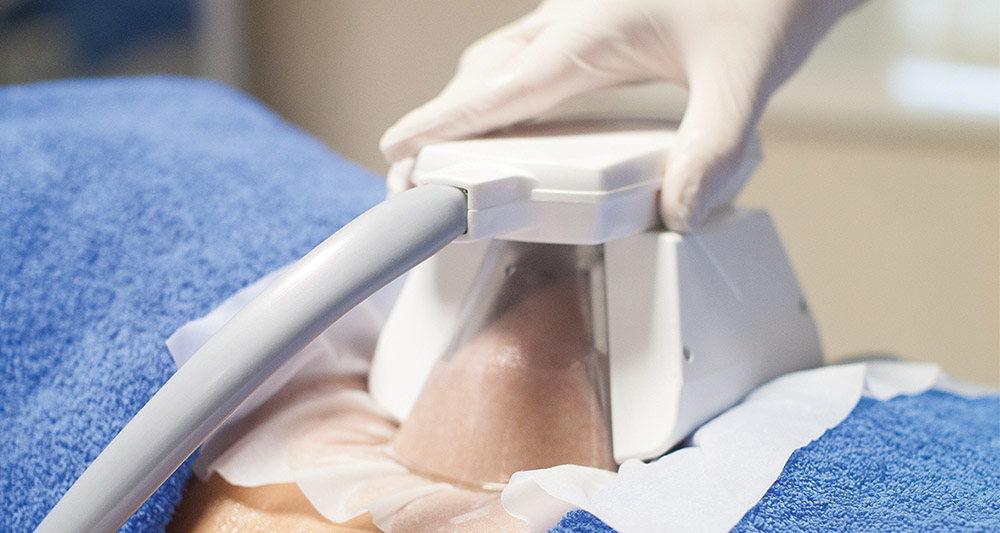 How Fat Freezing and HIFU Work Together? 2 Multiple Areas in One Session HIFU and Fat Freezing Shoreham Beach